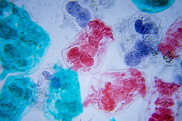 Microscopic image of Rotifera ( cross-section)