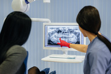 The Dentist Shows A Picture Of The Patient's Teeth And Tells The Necessary Treatment. Dentistry, Health.