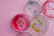 Growth of different bacterial cultures, concept. Bacteriological examination. Harmful and beneficial bacteria,