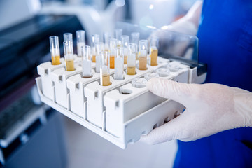 Wall Mural - express analysis of human urine in medical laboratory. lab technician holds test tube setup
