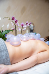 Cups applied to back skin of a female patient as part of the traditional method of cupping therapy