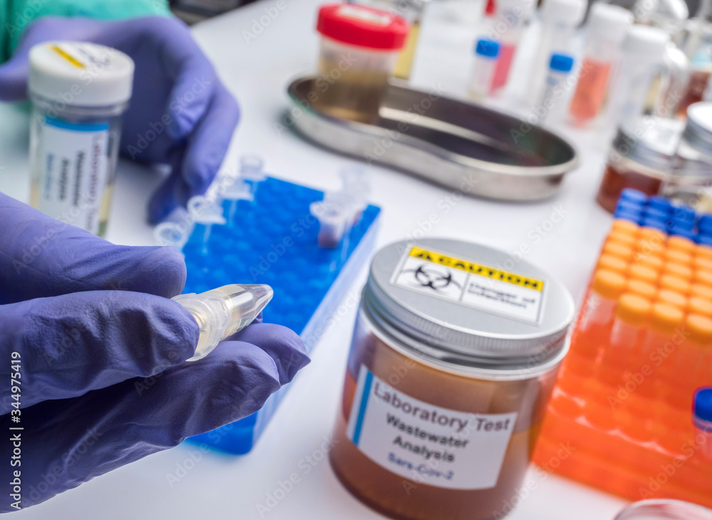Scientific analysis of wastewater sample in laboratory, investigation ...