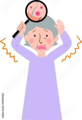 頭皮に赤い吹き出物が出来て悩むおばあちゃんのベクターイラスト Buy This Stock Vector And Explore Similar Vectors At Adobe Stock Adobe Stock 頭皮に赤い吹き出物が出来て悩むおばあちゃんのベクターイラスト Buy This Stock Vector And Explore Similar Vectors At Adobe Stock Adobe Stock