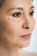 © LIGHTFIELD STUDIOS - asian woman with plastic surgery lines on face isolated on grey