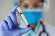 © Tinnakorn - Doctor holding test tube with blood sample for COVID-19 test, novel coronavirus 2019.