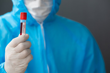 Medical Scientist in PPE suit and holding blood test sample of infected person covid-19 for vaccine research prevent or treat the new coronavirus SARS-CoV-2