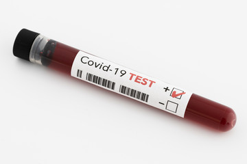 positive blood test result