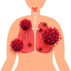 Wall Mural - Covid 19 concept. Coronavirus infection of human lungs cells in the human body isolated on white background