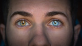 Fototapeta  - Man with heterochromia