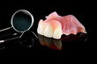 Dental prosthetic isolatic - partial denture upper side.