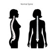 Woman healthy spine vector illustration
