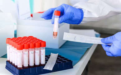 Covid 19 swab test