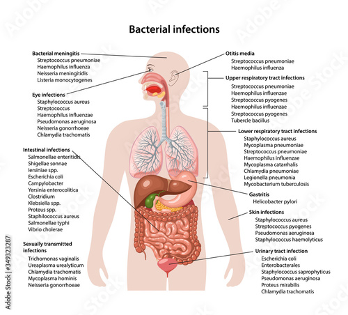 The Main Bacterial Infections That Cause Diseases Of Parts Of The Human Body With A Description Of Bacteria Microbiology Vector Illustration In Flat Style Isolated Over White Background Stock Vector Adobe