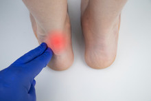 An Orthopedic Doctor Examines A Woman's Leg. Achilles Tendon And Ankle Diseases. Inflammation Of The Heel And Foot, Achillobursitis And Achillotomy, Rheumatism, Tendon Rupture