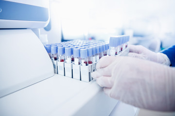 Woman medic working with blood sample in laboratory, blue color