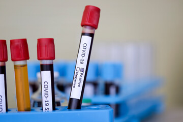 Wall Mural - health problem concept; the tube of blood samples in the rack, waiting to be check in the hospital