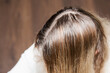 © Julia Kiseleva - Going gray. Woman shows her gray hair roots.