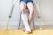 Close-up of children's feet, one leg is broken and in a cast, next to crutches. Light background. 
