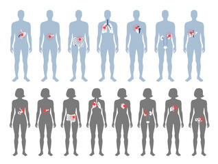 Poster - Pain in human body