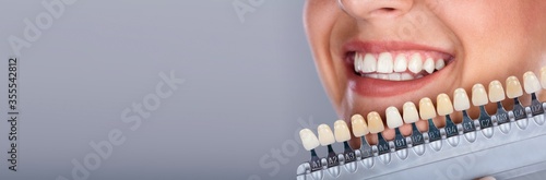 Fotomural Woman Matching Shade Of The Implant Teeth