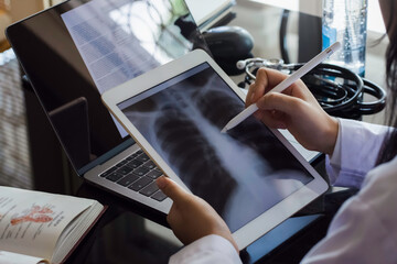 Female doctor hand holding digital tablet with chest x-ray film (CXR ) on screen and work on laptop computer at the office in clinic or hospital. Medical and health care concept.