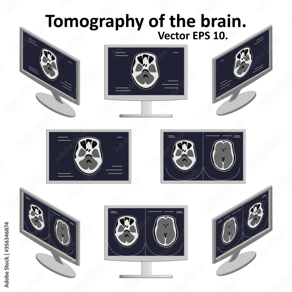 Set of cross section of the brain during magnetic resonance imaging on ...