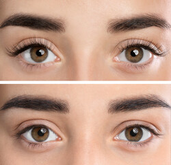 Poster - Collage with photos of young woman before and after eyelash extension procedure, closeup