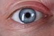 © H_Ko - Close-up of elderly mans eye. Macro shot of senior male looking and posing on camera. Beautiful blue colour eyeball. Wrinkles and moles on face. Youth and ageing. Natural appearance concept