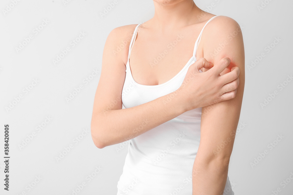 Young woman scratching her skin on light background