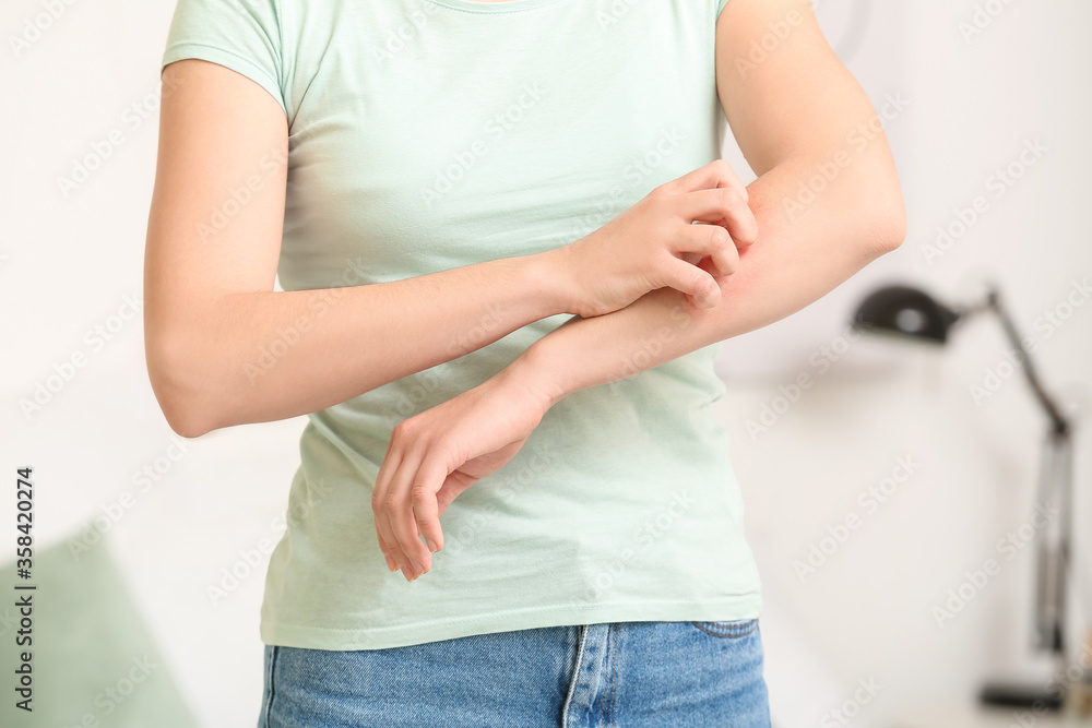 Young woman scratching her skin at home