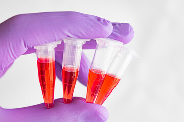 Several red samples in a 1.5 ml microcentrifuge tube in gloved hand