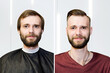 guy before after haircut Concept for a barber shop: the problem man of hair loss, alopecia, transplantation