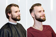 bearded guy before after haircut Concept for a barber shop: the problem man of hair loss, alopecia, transplantation