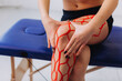 © dsheremeta - Young sportive female athlete holding her injured leg after treatment with kinesio tape. Kinesiology, physical therapy, rehabilitation concept