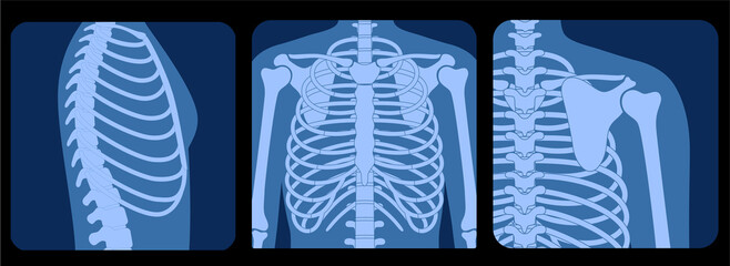 Poster - Skeleton x ray