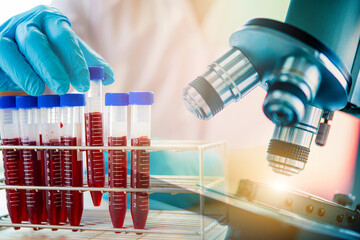 lab technician assistant analyzing a blood sample in test tube at laboratory with microscope. Medical, pharmaceutical and scientific research and development concept.