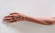 © yongyut - Hands and arm of an old man on a white background