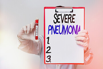 Conceptual hand writing showing Severe Pneumonia. Concept meaning acute disease that is marked by inflammation of lung tissue Laboratory blood test sample for medical diagnostic analysis