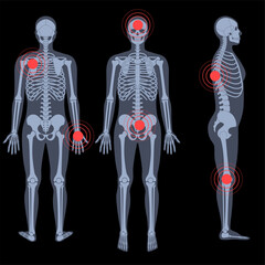 Sticker - Skeleton x ray