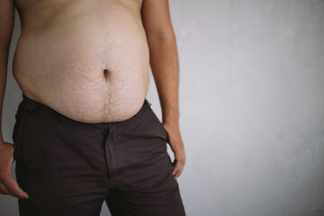 Wall Mural - Overweight man with excess belly fat, copy space. Weight loss, diet and health care concept