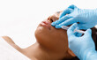 © Prostock-studio - Botox lip flip for young african woman