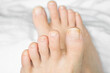 © Patrycja - Toenails on a woman's feet