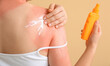 Woman with red sunburned skin applying cream against color background, closeup