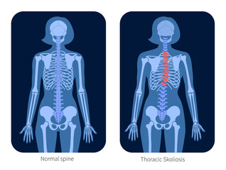 Wall Mural - Spine X ray