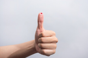 Bleeding blood from the cut finger wound. Injured finger with bleeding open cut wound. Closeup of finger human hand is cut hurt bleeding with bright red blood. 