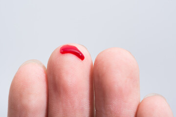 Bleeding blood from the cut finger wound. Injured finger with bleeding open cut wound. Closeup of finger human hand is cut hurt bleeding with bright red blood. 