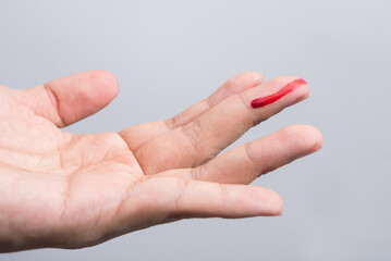 Wall Mural - Bleeding blood from the cut finger wound. Injured finger with bleeding open cut wound. Closeup of finger human hand is cut hurt bleeding with bright red blood. 