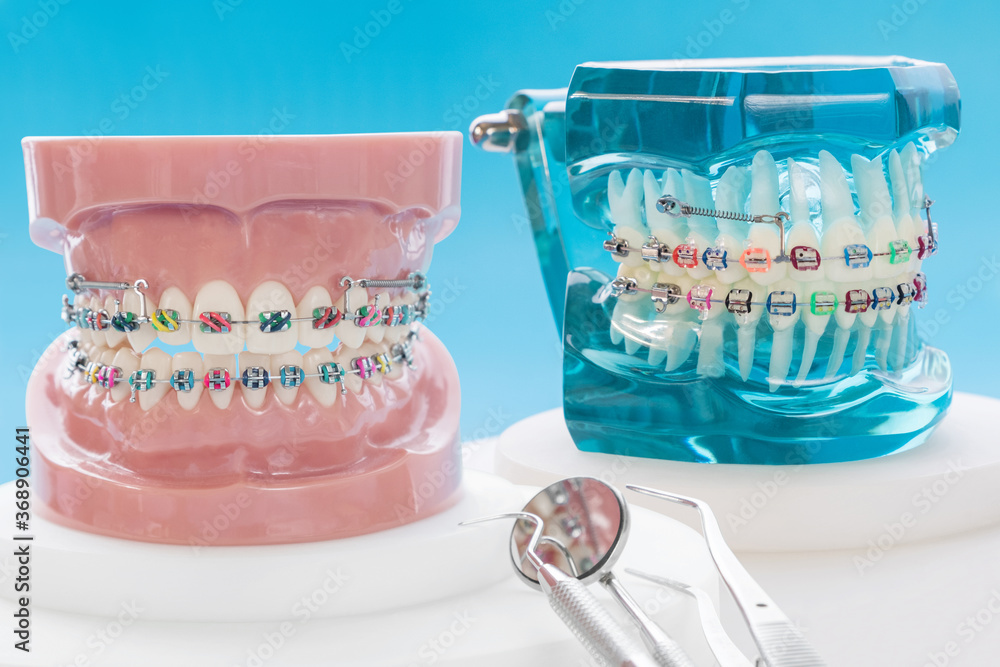 orthodontic model and dentist tool - demonstration teeth model of ...