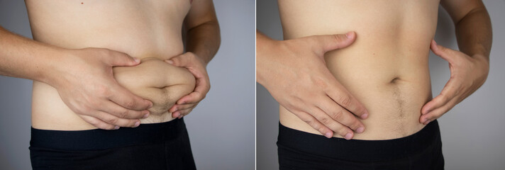 The man shows the results of work on the body. Before and after a thick and thin waist. In the photo on the left, belly fat is visible. In the photo on the right, a thin waist without extra kilograms