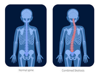 Wall Mural - Spine X ray